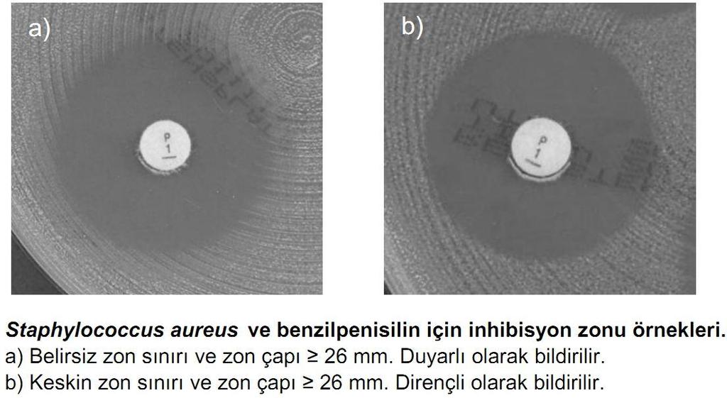 S. aureus ve