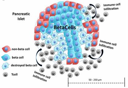 BAĞIŞIKLIK SİSTEMİYLE İLGİLİ YAKLAŞIMLAR ü T1D bağışıklık sistemi hücrelerinden biri olan T hücrelerinin kişinin kendi insülin salgılayan beta hücrelerine saldırması sonucu oluşan otoimmün bir
