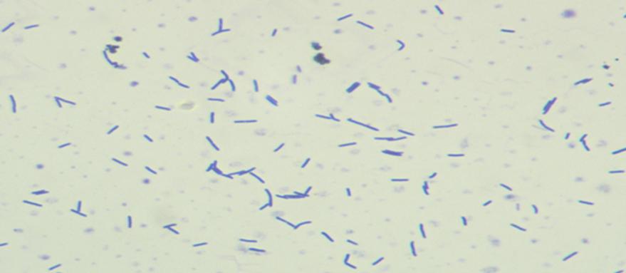 ISOLATION AND COUNTING OF LIVING LACTIC ACID BACTERIA FROM COMMERCIAL YOGHURT SAMPLES 86 Şekil 2. Gram pozitif Laktobasiller 3.