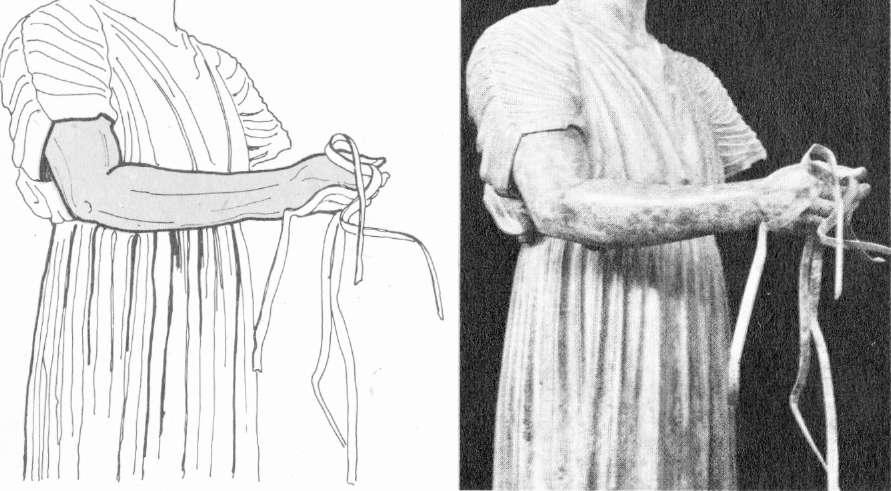 Geçiş üslupları - «a- Hippias ve Hipparkhos adındaki zorba hükümdarlara karşı çıkıp ikincisini öldüren (İ.Ö. 514) Harmodios ve Aristogeiton'u temsil eden Tyrannoktonos'lar heykel grubundan bir figür.