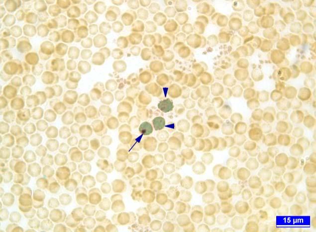 SUR, AYDIN, ÖZNURLU, TELATAR, ÇELİK algılayabilecekleri sperm hücresinin kendi bünyeleri içerisinde ilerlemesine ve genetik Şekil 3: Gebe olmayan bir sığırın perifer kan frotisinde ACP-az