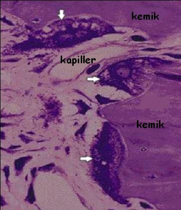 2.1.3.3 Osteoklast Osteoklastlar, kemik rezorbsiyonundan sorumludurlar ve aktiviteleri parathormon taraf ndan kontrol edilmektedir 25,31.