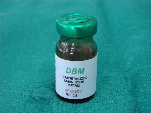 3.2 DBM Greft Materyali Bu çalışmada insan kemiğinden elde edilen bir DBM preparat olan Bioteck kullanılmıştır.