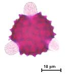 Polen Mikatrı Asteraceae (Papatyagiller) Bu familyanın üyeleri ülkemizde en yaygın doğal yayılışa sahip olan taksonlardır.