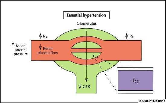 Renal