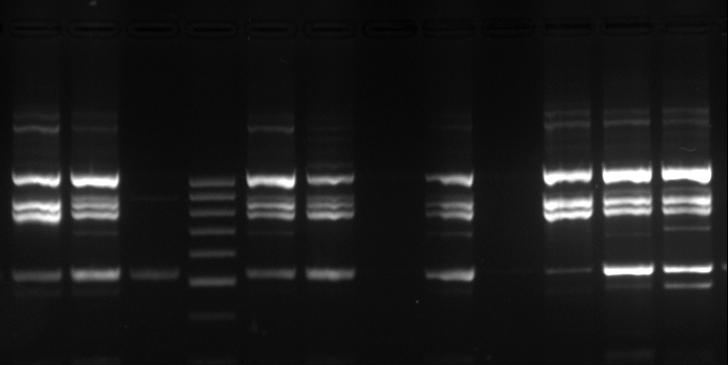 34 Aşağıda Çizelge 4.1, Çizelge 4.2, Çizelge 4.3 ve Çizelge 4.4 ile ilgili açıklamalar ve araştırmada kullanılan 8 adet primerden elde edilen RAPD-PCR bantlarına ilişkin bazı fotoğraflar verilmiştir.