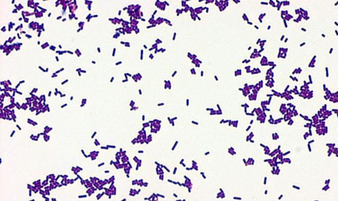 Listeria monocytogenes insanda genellikle enfeksiyon yapan tek listeria türüdür. (L. İva ovii ve L.