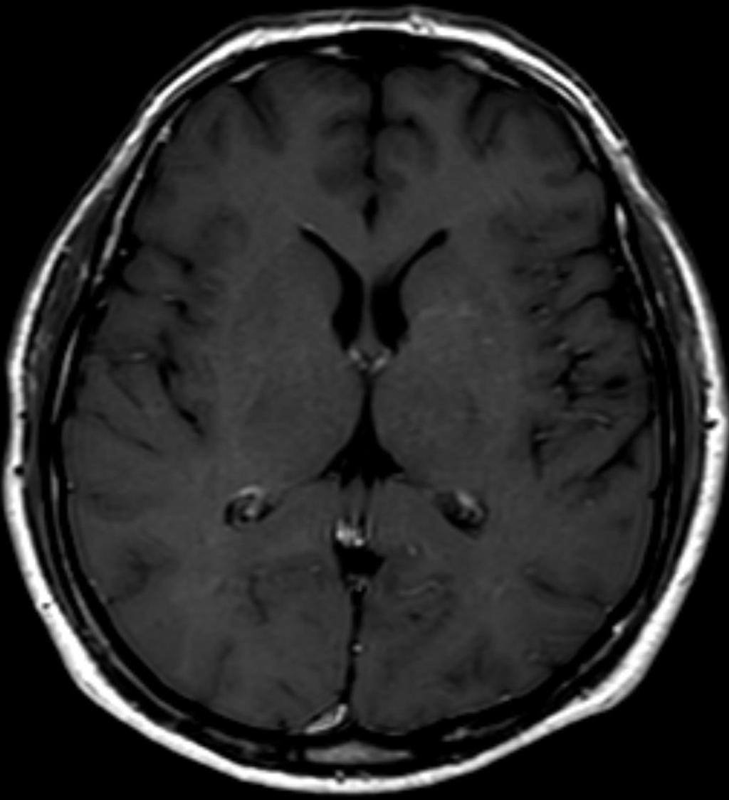 Crizotinib 6.