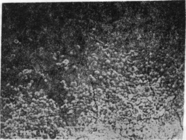 Jüvenil Periodontitis'te Elektron Mikroskop Bulguları nalarını andıran çukurcuklara rastlanmıştır. Çukurcukların 100 u.