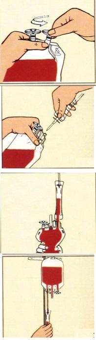 4. Dopo aver separato i componenti del sangue, sigillare le provette con il dispositivo di connessione sterile dal punto più vicino della sacchetto di trasferimento in base alle istruzioni per l'uso