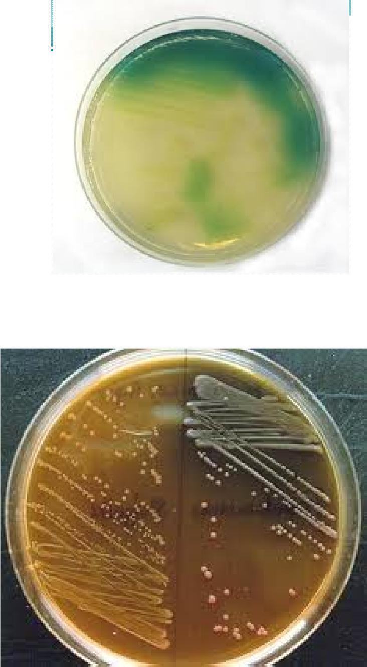 PSEUDOMONAS AERUGINOSA Hastane infeksiyonlarına