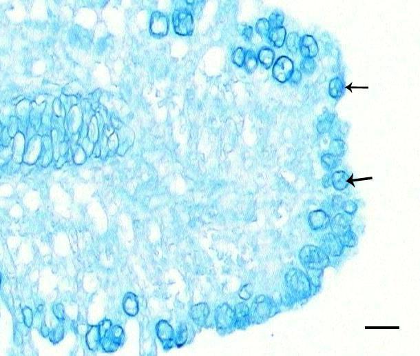 Primer lamel ucunda nötral ve asidik mukosubstansı birlikte içeren (ince ok) ve AB (+) içeren hücre(kalın ok) AB ph 2.5/PAS. Bar: 50 µm.