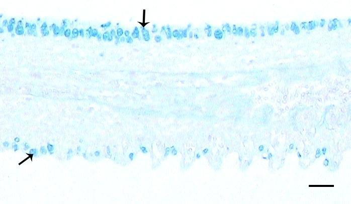 59. Primer lamelin orta bölgesinde mukus hücreleri (oklar).