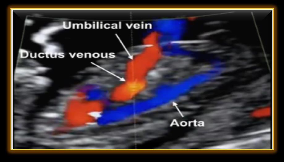 Duktus venozusdaki akımın değerlendirilmesinde gebelik yaşı 11 +0-13 +6 haftalarda ve CRL 45-84 mm arasında olmalıdır Fetus hareket