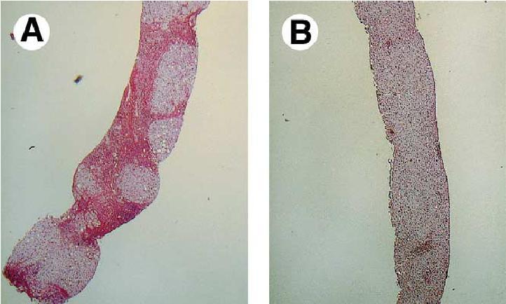 Serum HDV RNA Düzeylerinde Değişiklik Log 10 Genom/Equivalen/ml Serum HDV RNA Düzeylerinde