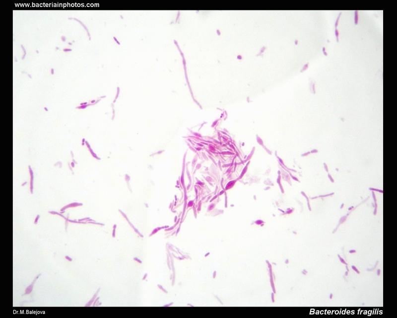 Gram boyaması-bacteriodes; pleomorfic gram