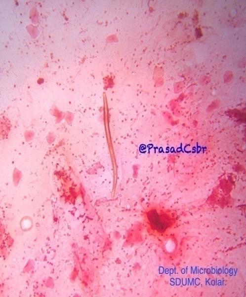 parazit (Trichomonas, Strongiloides) boyar Hücre duvarı olmayan veya çok küçük bakterileri boyamaz