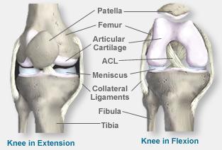 ACL: Anterior cruciate ligament ġekil 1.