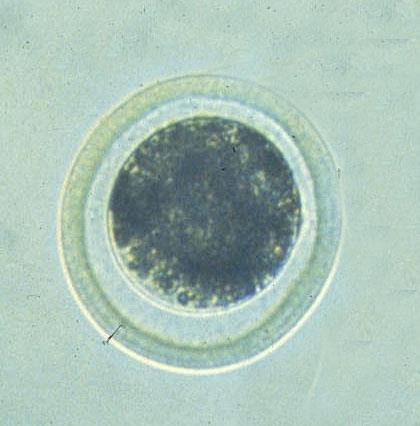 Embriyo nedir?