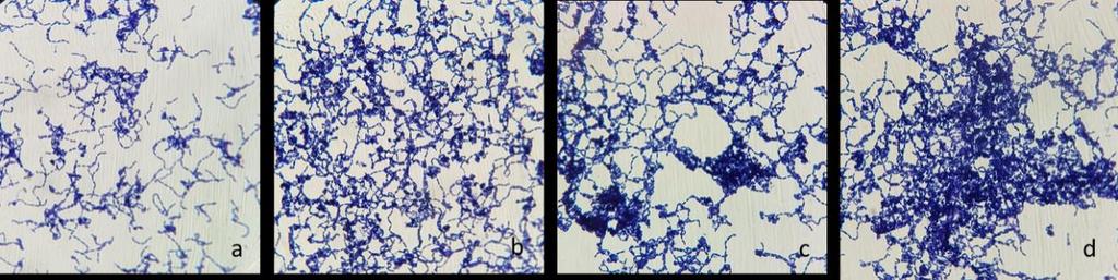 Çalışma sonunda vajinal LAB nin pek çoğunun C. albicans ve E. coli ile iyi koagrege oldukları belirlenirken P. aeruginosa ile koagrege yeteneklerinin düşük olduğu tespit edilmiştir.