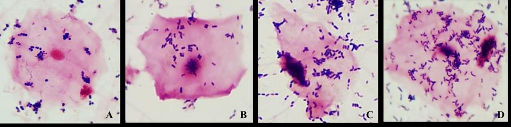 Şekil 4.18. Bazı vajinal LAB nin üroepitelyal hücrelerle 3. saatin sonundaki gram boyama görüntüleri; A (+1); L6: P. acidilacitici, B (+2); L1: L. paracasei, C (+3); L16: L. plantarum, D (+4); L9: L.