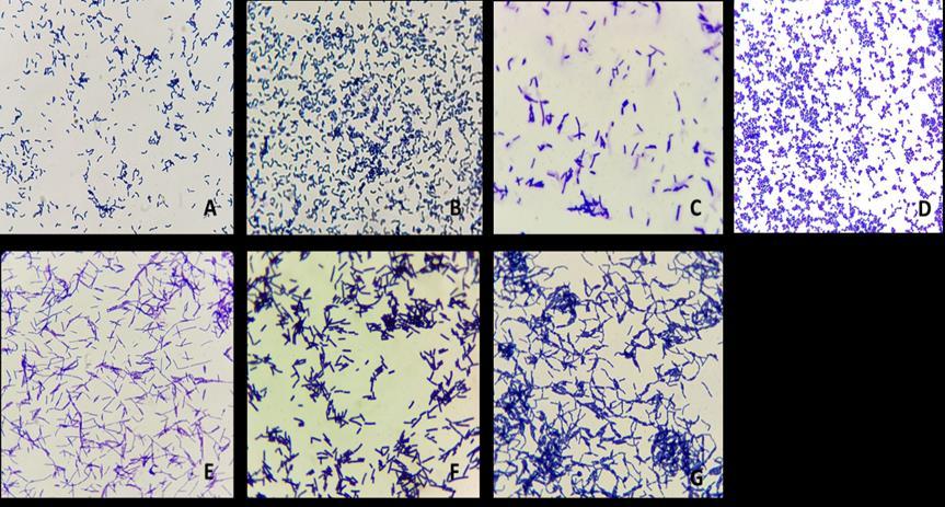 Şekil 4.1. Vajinal mikrofloradan izole edilen 7 farklı türün gram boyama görüntüleri; A: L1: L. paracasei, B: L9: L. plantarum, C: L5: L. crispatus, D:L7: P. acidilactici, E: L11: L.