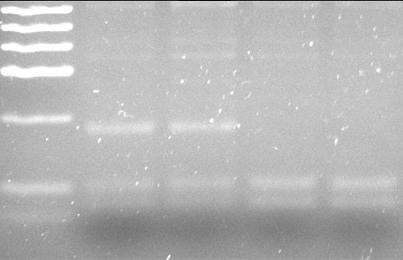 4.3 PCR Ürünlerinin TaqI Restriksiyon Enzimi ile Kesilmesi ve Genotiplerin Belirlenmesi Shuster et al.
