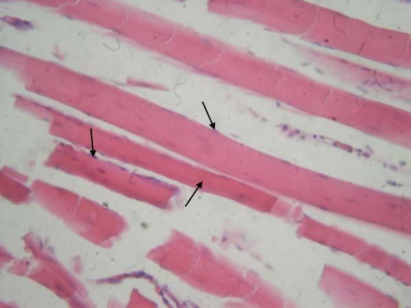 Myolifler (A), çizgilenmeler (B) ve hücrelerin