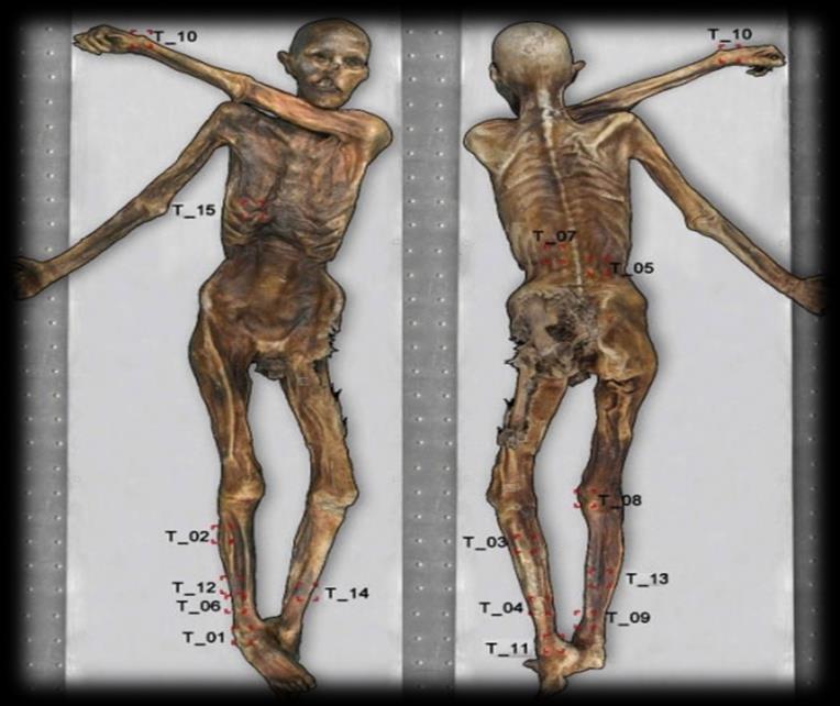 DÜNYA NIN EN ESKİ DÖVMESİ BUZ ADAM ÖTZİ NİN Dünyanın en eski dövmesi üzerine yapılan tartışmalar sonuçlandı.