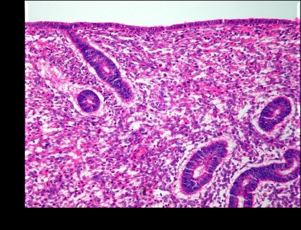 Stroma Hücreleri Salgı ve protein ifadeleri