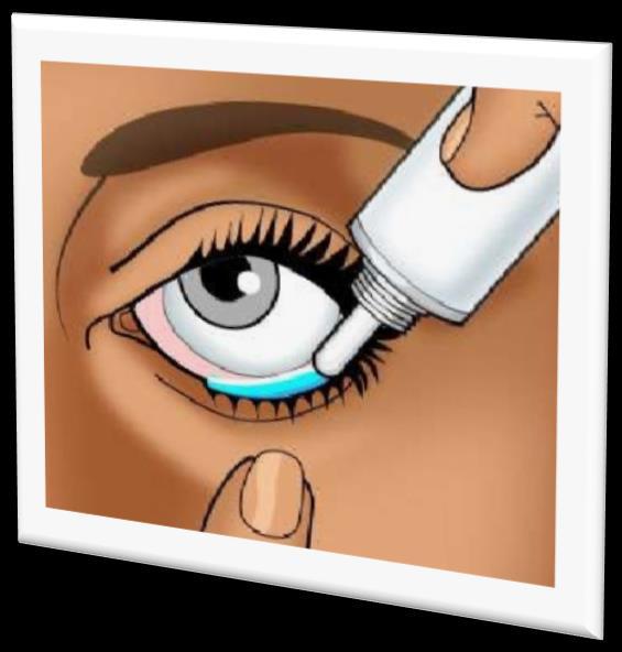 Göz Merhemleri Konjunktiva veya gözkapaklarına uygulanan steril merhemlerdir.