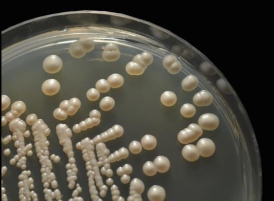 (%5-10) Pneumocystis