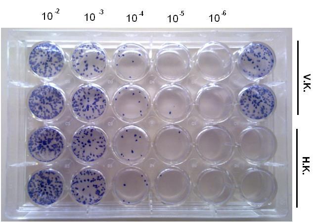 Focus Forming Assay (FFA)