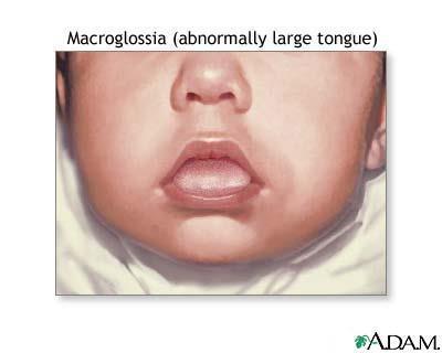 Anatomy Tongue Large compared to the size of the oral cavity Epiglottis