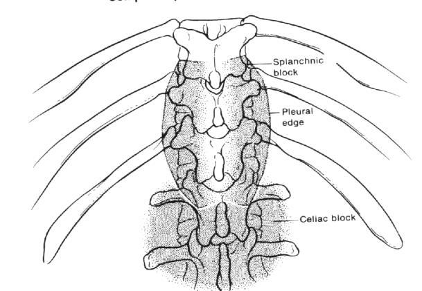 Retroperitoneal ve üst abdominal bölge malign/nonmalign