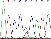 I II III p.p/wt p.pr/wt IV p.p/p.p p.pr/p.p Şekil -: ATPVB genindeki p.pr mutasyonunun DF#9 ailesindeki segregasyonu.