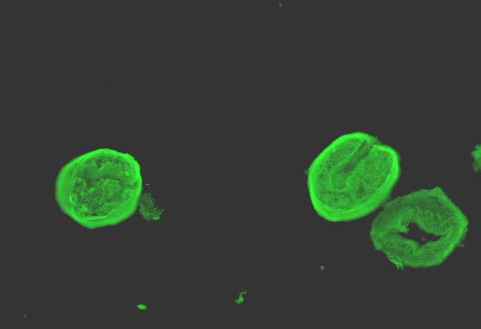 Resim-8: Ticari IFA Testi ile E. granulosus un pozitif görünümü (Çalışmamızdan) İn-house IFAT ile elde edilen pozitif ve negatif hasta sayıları Tablo-3 de görülmektedir.