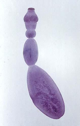 Resim-1:Erişkin Echinococcus granulosus (9). 2.3.2. Yumurta Ekinokok yumurtaları yuvarlak veya ovaldir.
