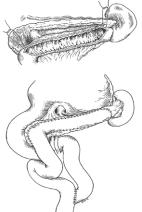 Nihat Yavuz fiekil 1. Longitudinal pankreatikojejunostomi (Partington-Rochelle); (Modifiye Puestow-Gillesby).