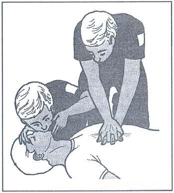 Bir yaralıya hem suni solunum, hem de kalp masajı birlikte yapılacaksa: Sadece bir ilkyardımcı varsa önce 2 defa suni solunum yapar, sonra 15 kalp masajı yapar ve bu şekilde devam eder.