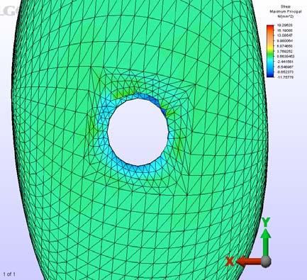 64 A B Şekil 3.20. Model 3 için sinüs kortikal kemik seviyesi maksimum principal stres dağılımı.