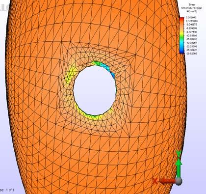 82 A B Şekil 3.50. Model 4 için dik yükleme koşulunda sinüs kortikal kemik seviyesi minimum principal stres dağılımı (A- Dik yükleme koşulu.