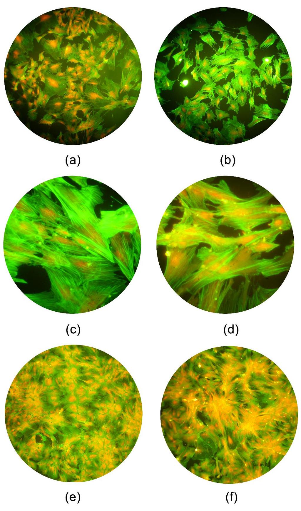 Şekil 4.20. Fotostimülasyon çalışmaları kapsamında TCPS yüzeylerde kültüre edilen AdMSC lerin floresan mikroskop görüntüleri; (a) kontrol grubu, 4.