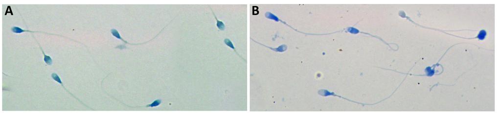 56 4. BULGULAR 4.1. Anilin Mavisi Boyanması Sperm morfolojisinin ve kromatin yoğunlaşmasının incelenmesi için Anilin mavisi boyaması yapıldı.