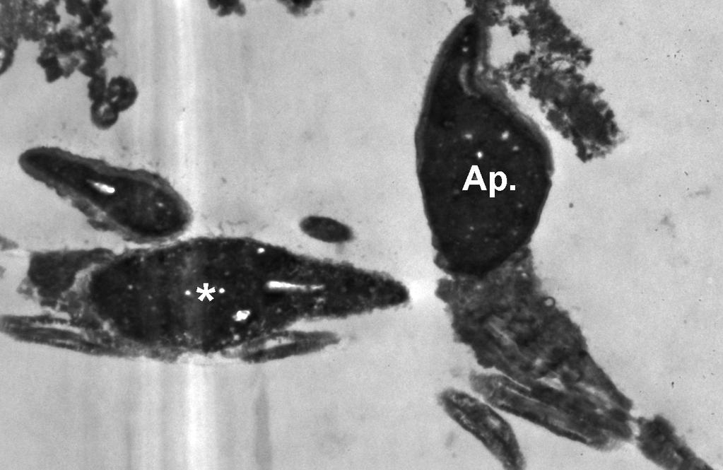 gösteren apopitotik sperm (x20 000).