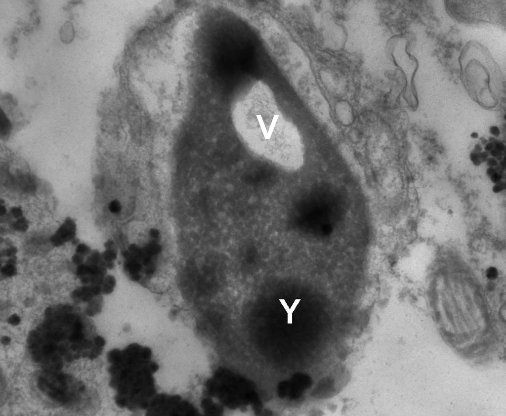 59 Resim 4-6: Hem nüklear kromatinde vakuol oluşumunun (V) hem de kromozomal yoğunlaşmanın görüldüğü apopitotik bir sperm hücresi (x30 000).