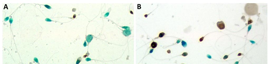 61 4.4. Apopitoz Tayini Bulguları ApopTag Peroxidase In situ Apoptosis Detection Kit