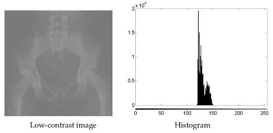 Histogram İşleme Düşük Kontrast Görüntü: Tüm