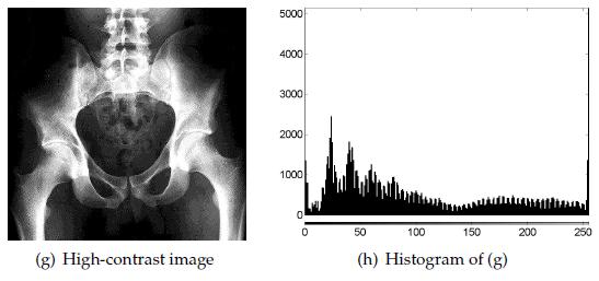 Histogram İşleme Yüksek Kontrast Görüntü: Tüm