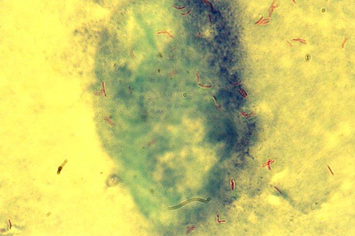 Bu besiyeri yüzeyinde kuru, sarımsı, karnabahara benzer koloniler şeklinde (Mycobacterium tuberculosis) veya basık,